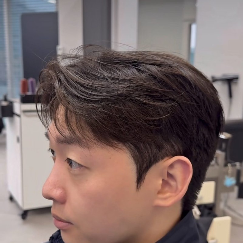 시술 후 스타일
