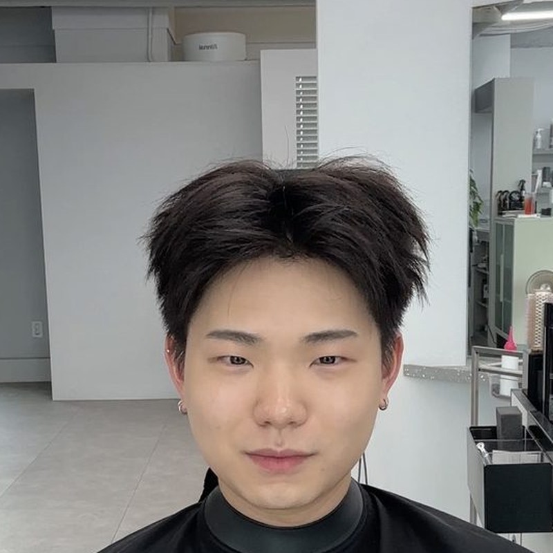 시술 전