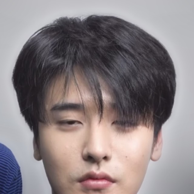 시술 전 머리