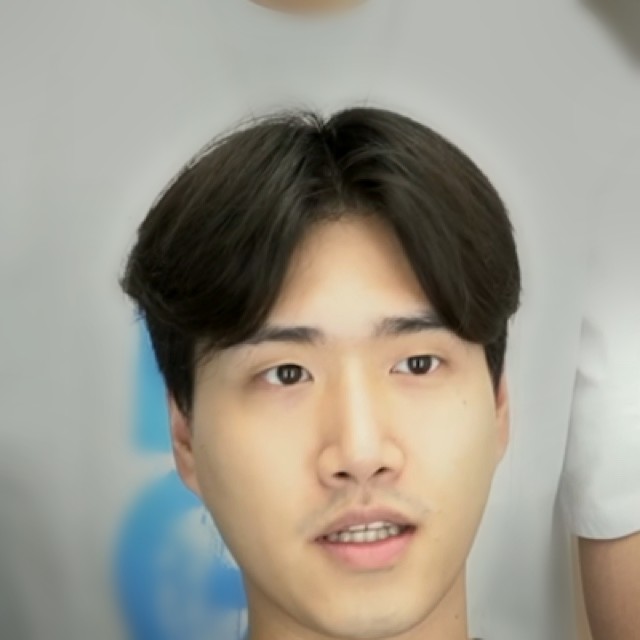 시술 전 머리